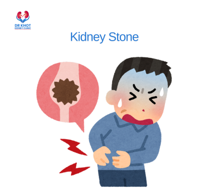 kidney-stone