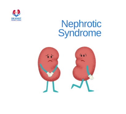 Nephrotic Syndrome: What It Is and How It’s Treated