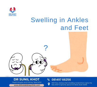 Swelling in Ankles and Feet: Warning Kidney Health