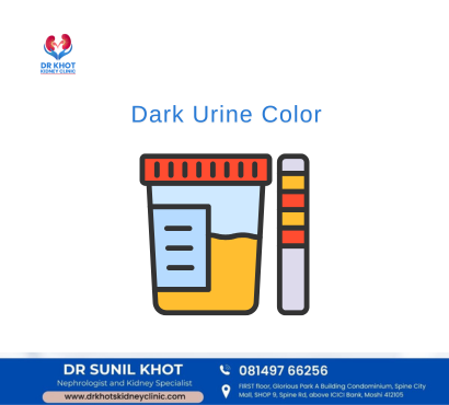 Dark Urine Color Changes: Red Flags for Kidney Health